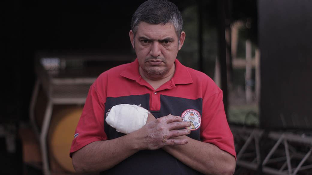 El bombero voluntario Omar López muestra las cicatrices del combate contra el fuego. 